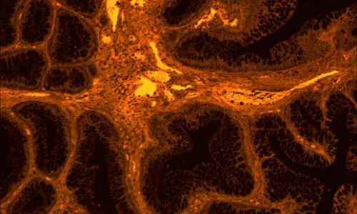 高靈敏度彩色成像